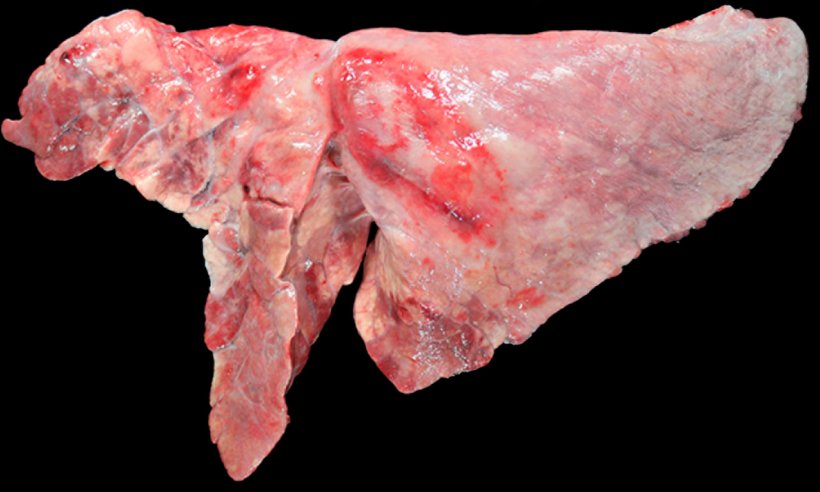 图5:猪肺炎支原体和胸膜肺炎支原体混合感染的猪肺.