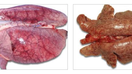 Lungs