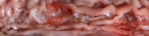 小肠末端肠粘膜增厚