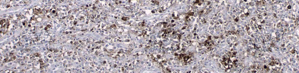 免疫组化检测PCV2抗原