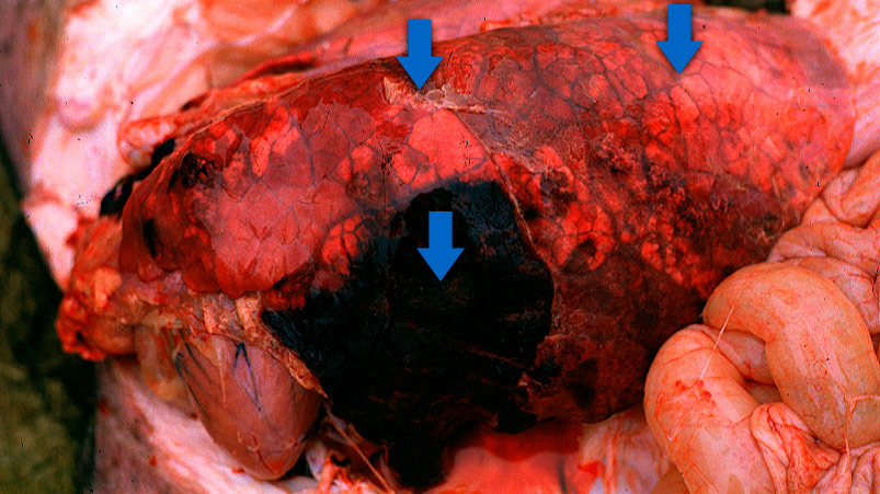 acute pulmonary edema图片