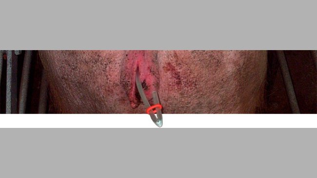 Closing the catheters with a rubber band