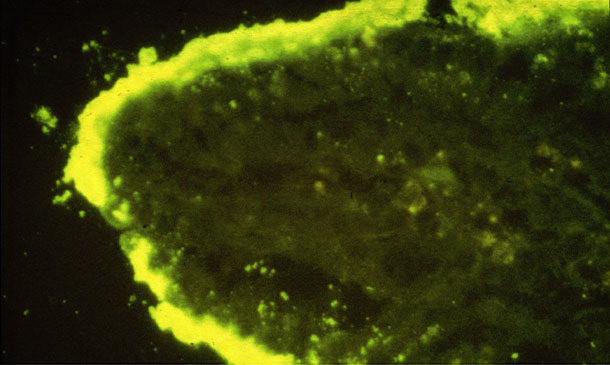 Dense colonies of E coli attached on an intestinal villus