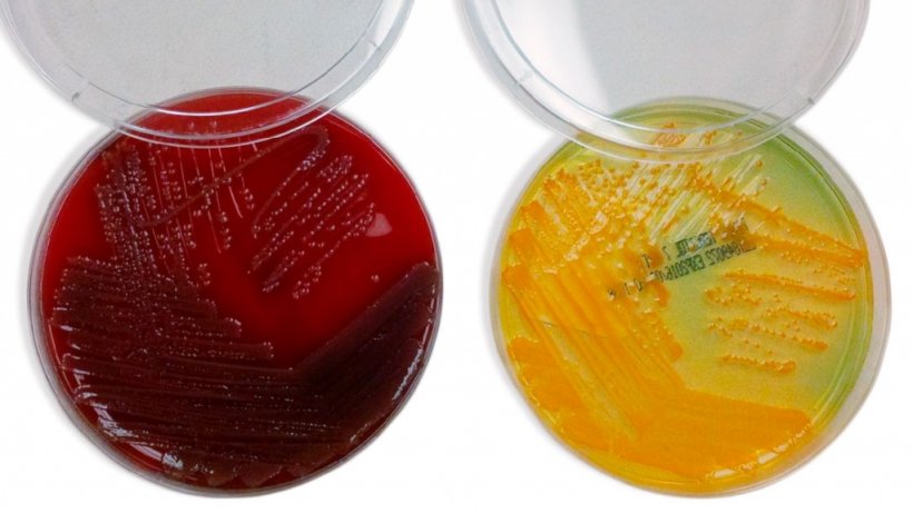 Differential cultures for the diagnosis of E. Coli