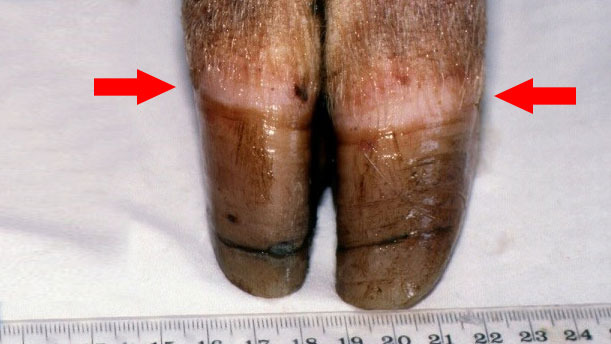Figure 1. Coronary band [arrow]. Note uneven growth and cracking of horn.
