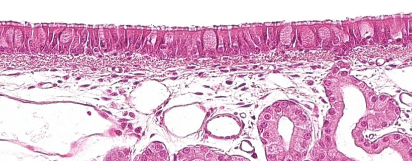 图1:具有杯状细胞的纤毛假复层上皮,是呼吸系统的特征。