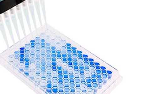 照片1：用于PRRSV血清学检测的平底96孔ELISA板。阳性样本显示为蓝色。资料来源：碱基对生物技术。