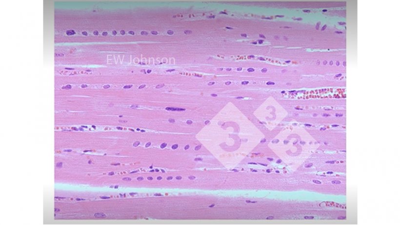 Figure 3: Heart muscle with haemorrhage, hyaline necrosis, and rowing of the nucleus showing vitamin E and selenium deficiency. These pigs would not have a normally functioning immune system.
