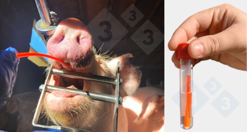 ‍气管支气管刮取物样本的采集。